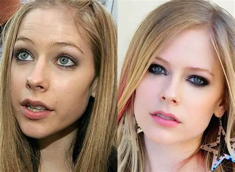 Avril Lavigne’s Alleged Boob Job: A Comprehensive Examination